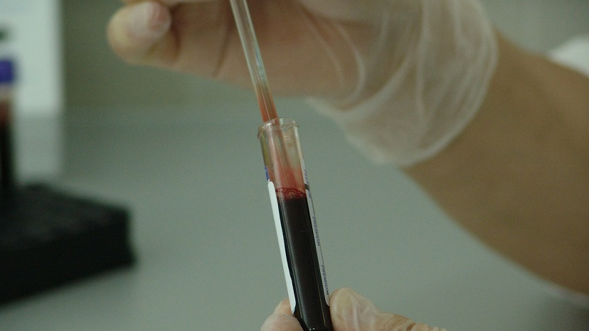 novel blood test may detect zika more accurately novel blood test may detect zika more accurately