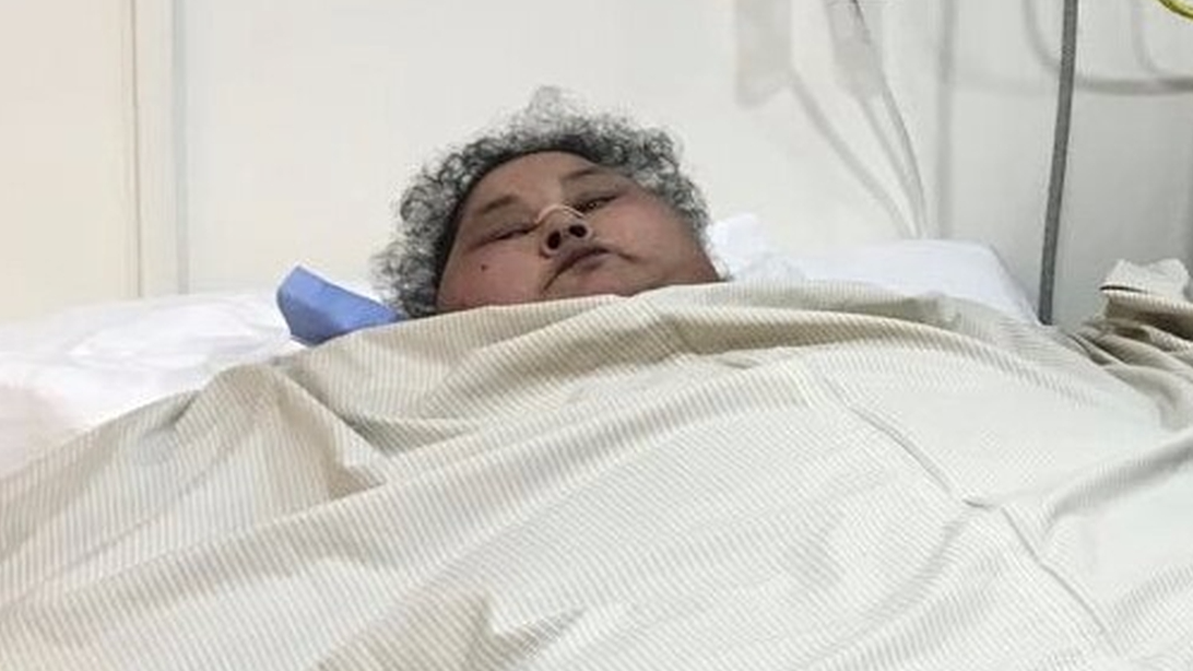 500 kg egyptian woman undergoes weight-loss surgery