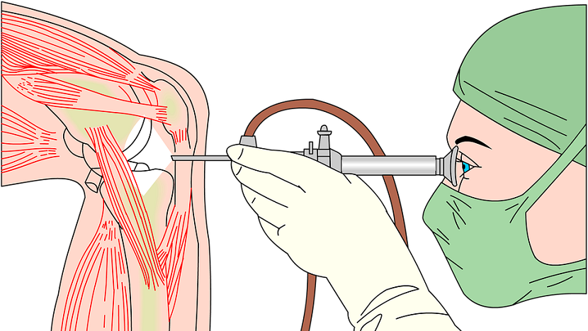 will capping the prices of knee implants really help patients?