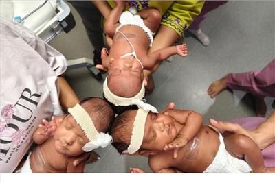 At 46, a diabetic and hypertensive mother delivers 25-week triplets with 2.5 kg combined weight through IVF

